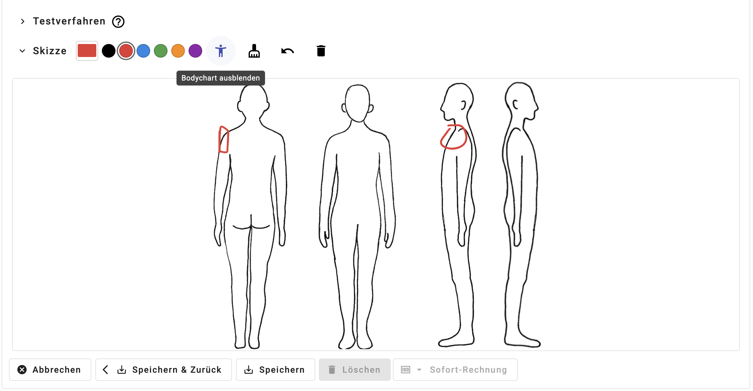 Body-Chart mit Zeichenwerkzeugen